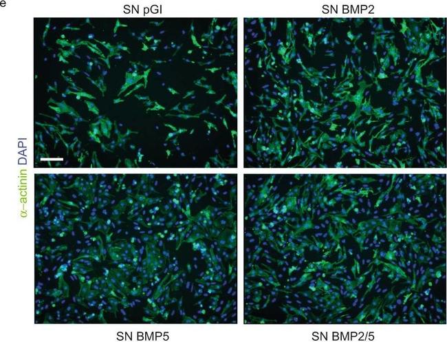 Mouse IgG (H+L) Highly Cross-Adsorbed Secondary Antibody in Immunocytochemistry (ICC/IF)