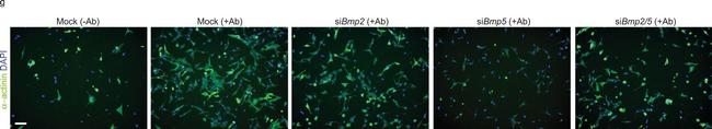 Mouse IgG (H+L) Highly Cross-Adsorbed Secondary Antibody in Immunocytochemistry (ICC/IF)