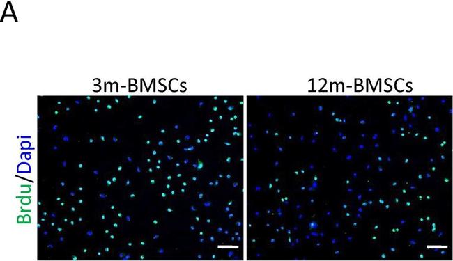 Mouse IgG (H+L) Highly Cross-Adsorbed Secondary Antibody in Immunocytochemistry (ICC/IF)