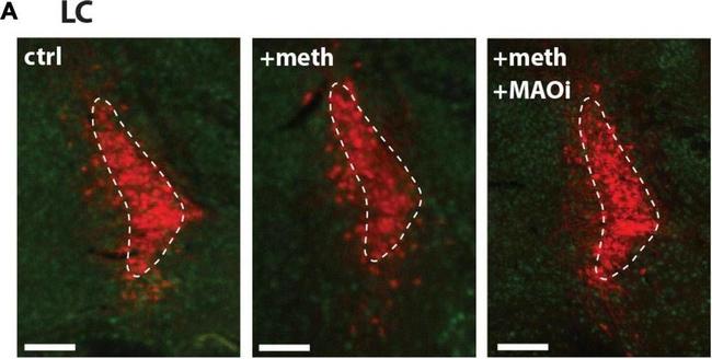 Mouse IgG (H+L) Highly Cross-Adsorbed Secondary Antibody in Immunohistochemistry (IHC)