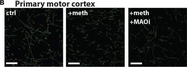 Mouse IgG (H+L) Highly Cross-Adsorbed Secondary Antibody in Immunohistochemistry (IHC)