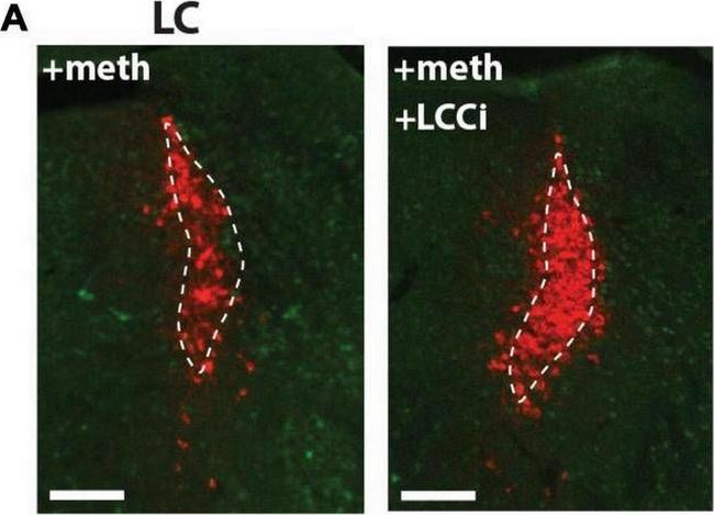 Mouse IgG (H+L) Highly Cross-Adsorbed Secondary Antibody in Immunohistochemistry (IHC)