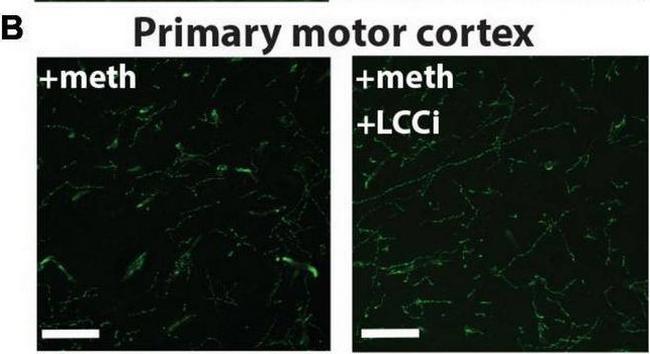 Mouse IgG (H+L) Highly Cross-Adsorbed Secondary Antibody in Immunohistochemistry (IHC)