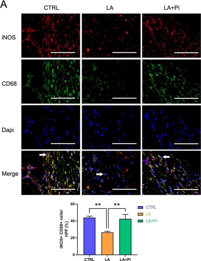 Mouse IgG (H+L) Highly Cross-Adsorbed Secondary Antibody in Immunocytochemistry (ICC/IF)