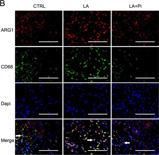 Mouse IgG (H+L) Highly Cross-Adsorbed Secondary Antibody in Immunocytochemistry (ICC/IF)