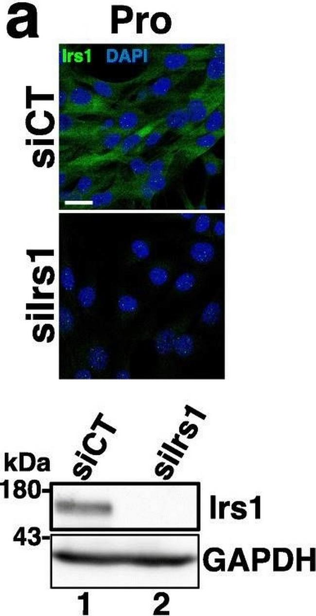 Rabbit IgG (H+L) Highly Cross-Adsorbed Secondary Antibody in Immunocytochemistry (ICC/IF)