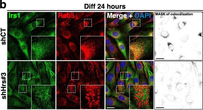 Rabbit IgG (H+L) Highly Cross-Adsorbed Secondary Antibody in Immunocytochemistry (ICC/IF)