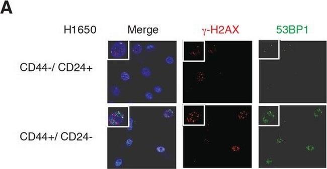 Mouse IgG (H+L) Highly Cross-Adsorbed Secondary Antibody in Immunocytochemistry (ICC/IF)