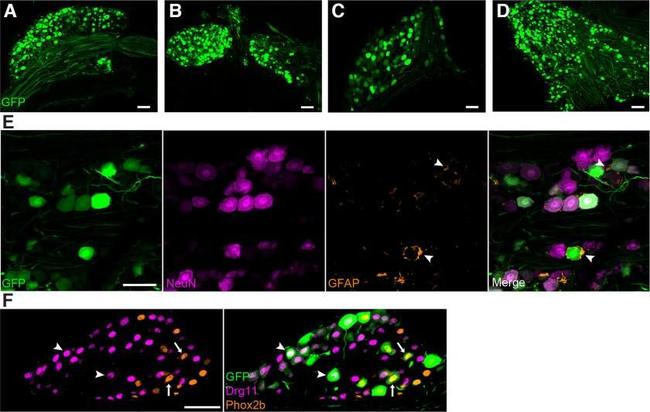 Rabbit IgG (H+L) Highly Cross-Adsorbed Secondary Antibody in Immunocytochemistry (ICC/IF)