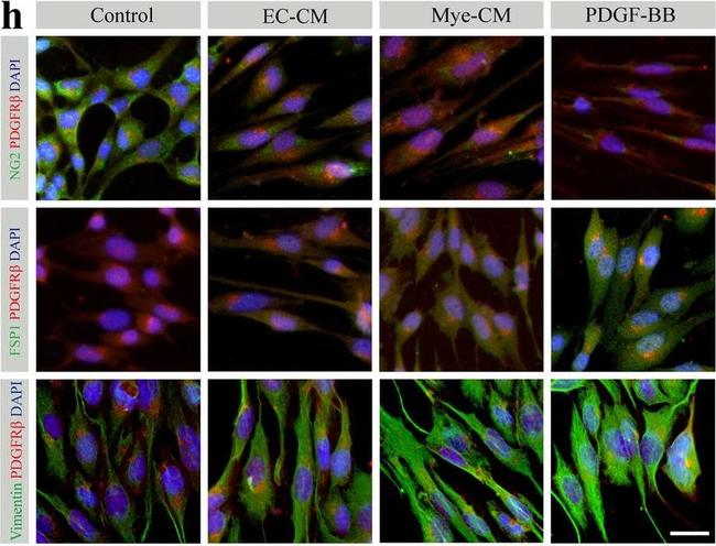 Rabbit IgG (H+L) Highly Cross-Adsorbed Secondary Antibody in Immunocytochemistry (ICC/IF)