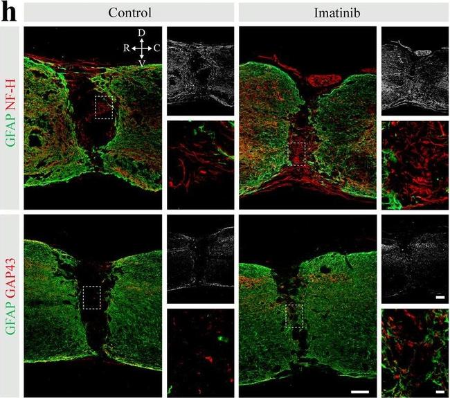 Rat IgG (H+L) Highly Cross-Adsorbed Secondary Antibody in Immunohistochemistry (IHC)