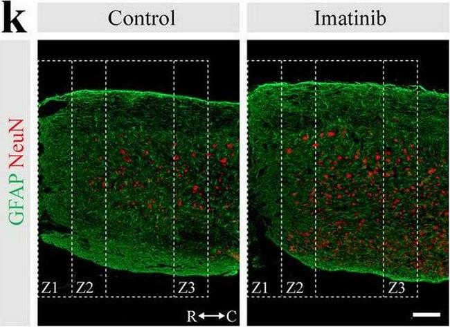 Rat IgG (H+L) Highly Cross-Adsorbed Secondary Antibody in Immunohistochemistry (IHC)