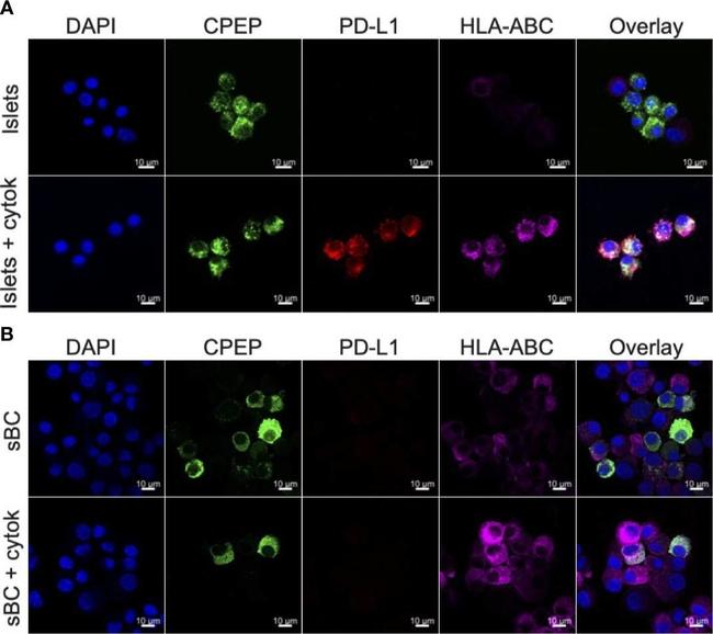 Rat IgG (H+L) Highly Cross-Adsorbed Secondary Antibody in Immunocytochemistry (ICC/IF)