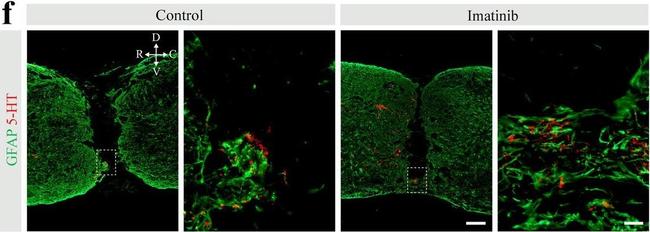 Rat IgG (H+L) Highly Cross-Adsorbed Secondary Antibody in Immunohistochemistry (IHC)