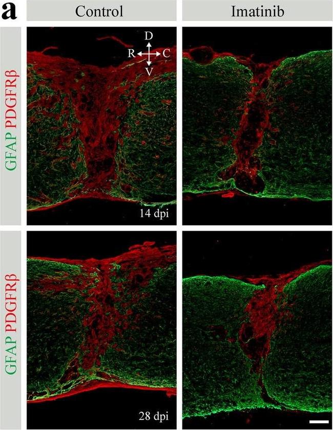 Rat IgG (H+L) Highly Cross-Adsorbed Secondary Antibody in Immunohistochemistry (IHC)