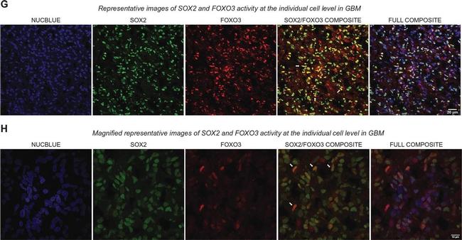 Rat IgG (H+L) Highly Cross-Adsorbed Secondary Antibody in Immunocytochemistry (ICC/IF)