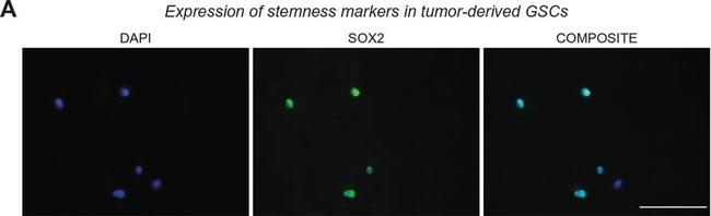 Rat IgG (H+L) Highly Cross-Adsorbed Secondary Antibody in Immunocytochemistry (ICC/IF)