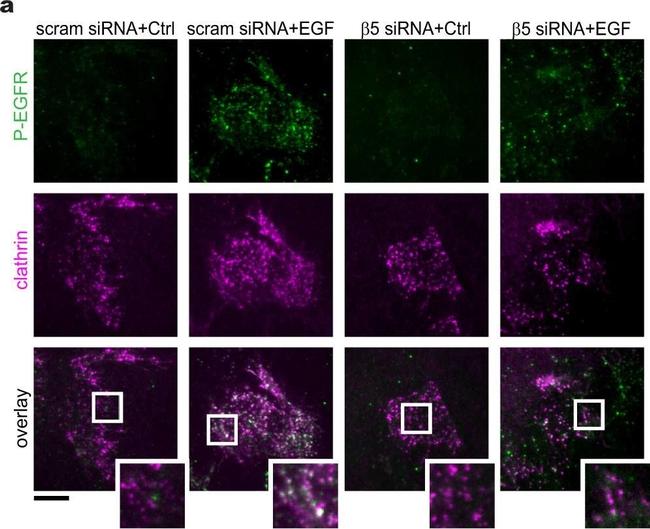 Mouse IgG (H+L) Cross-Adsorbed Secondary Antibody in Immunocytochemistry (ICC/IF)