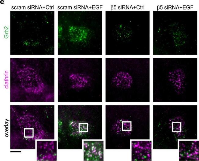 Mouse IgG (H+L) Cross-Adsorbed Secondary Antibody in Immunocytochemistry (ICC/IF)