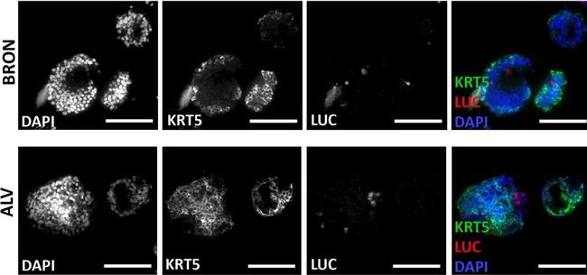 Goat IgG (H+L) Cross-Adsorbed Secondary Antibody in Immunohistochemistry (Paraffin) (IHC (P))