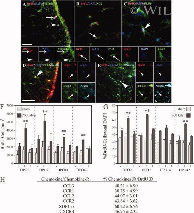 NG2 Antibody in Immunohistochemistry (IHC)