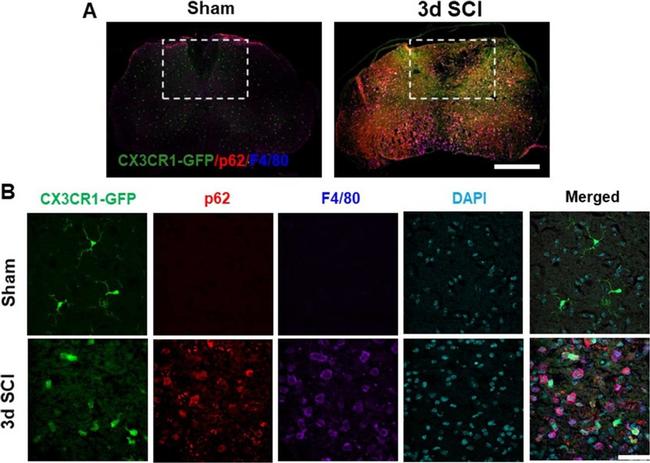 Rat IgG (H+L) Cross-Adsorbed Secondary Antibody in Immunohistochemistry (IHC)