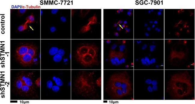 Rabbit IgG (H+L) Cross-Adsorbed Secondary Antibody in Immunocytochemistry (ICC/IF)