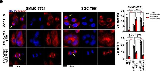 Rabbit IgG (H+L) Cross-Adsorbed Secondary Antibody in Immunocytochemistry (ICC/IF)