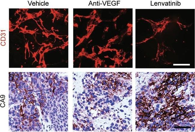 Goat IgG (H+L) Cross-Adsorbed Secondary Antibody in Immunohistochemistry (IHC)