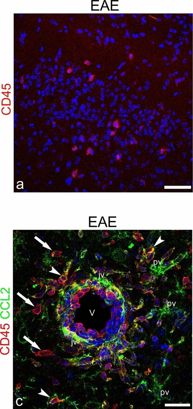 Rat IgG (H+L) Cross-Adsorbed Secondary Antibody in Immunohistochemistry (IHC)