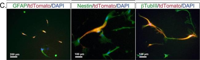 Mouse IgG (H+L) Highly Cross-Adsorbed Secondary Antibody in Immunocytochemistry (ICC/IF)