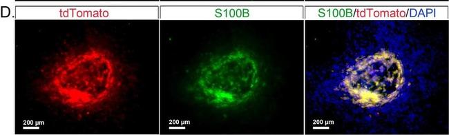 Rabbit IgG (H+L) Cross-Adsorbed Secondary Antibody in Immunocytochemistry (ICC/IF)