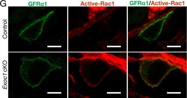 Rabbit IgG (Heavy chain) Secondary Antibody in Immunohistochemistry (Frozen) (IHC (F))