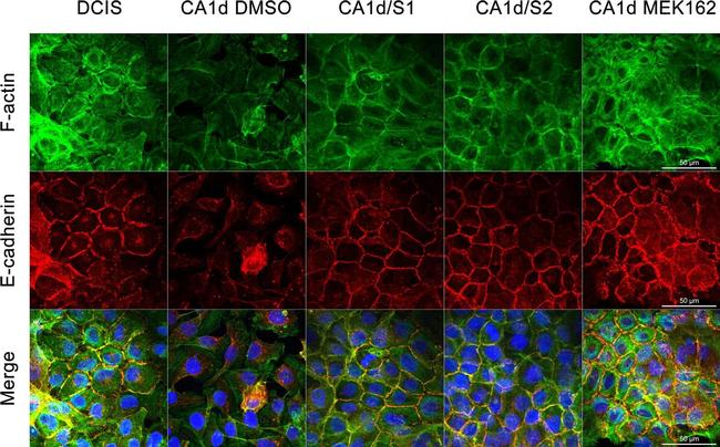 Mouse IgG (H+L) Highly Cross-Adsorbed Secondary Antibody in Immunocytochemistry (ICC/IF)