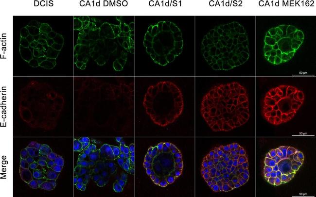 Mouse IgG (H+L) Highly Cross-Adsorbed Secondary Antibody in Immunocytochemistry (ICC/IF)