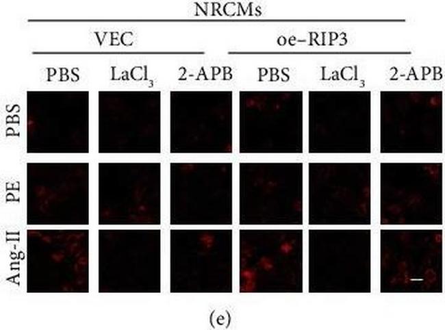 Mouse IgG (H+L) Highly Cross-Adsorbed Secondary Antibody in Immunocytochemistry (ICC/IF)