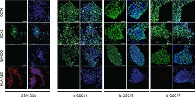 Mouse IgG (H+L) Highly Cross-Adsorbed Secondary Antibody in Immunocytochemistry (ICC/IF)