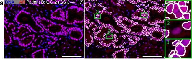 Rabbit IgG (H+L) Highly Cross-Adsorbed Secondary Antibody in Immunohistochemistry (Paraffin) (IHC (P))