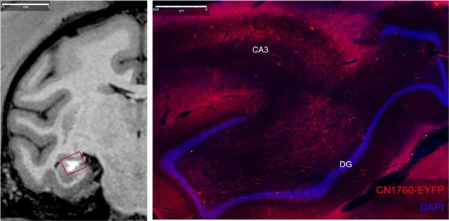 Rabbit IgG (H+L) Highly Cross-Adsorbed Secondary Antibody in Immunohistochemistry (IHC)