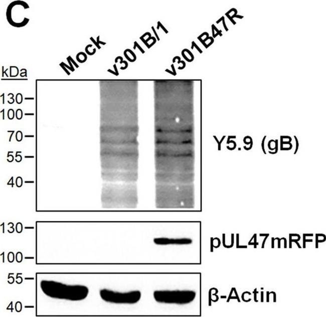 Rabbit IgG (H+L) Secondary Antibody in Western Blot (WB)