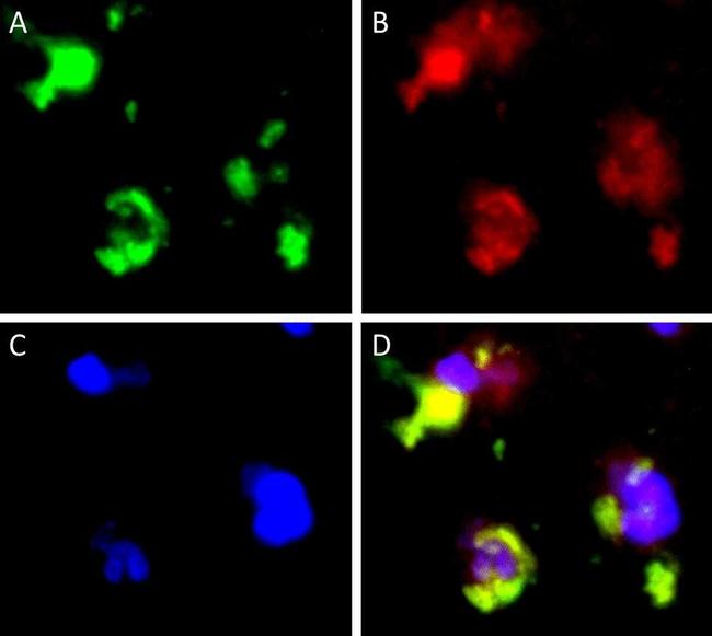 Rabbit IgG (H+L) Cross-Adsorbed Secondary Antibody in Immunohistochemistry (IHC)