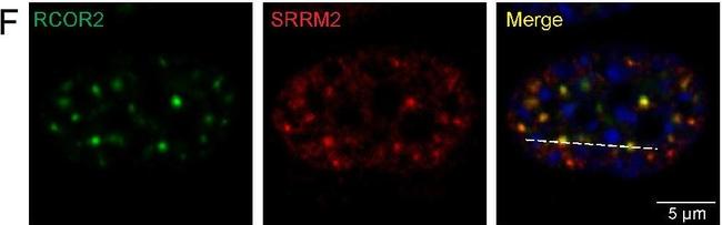 Rabbit IgG (H+L) Secondary Antibody in Immunocytochemistry (ICC/IF)