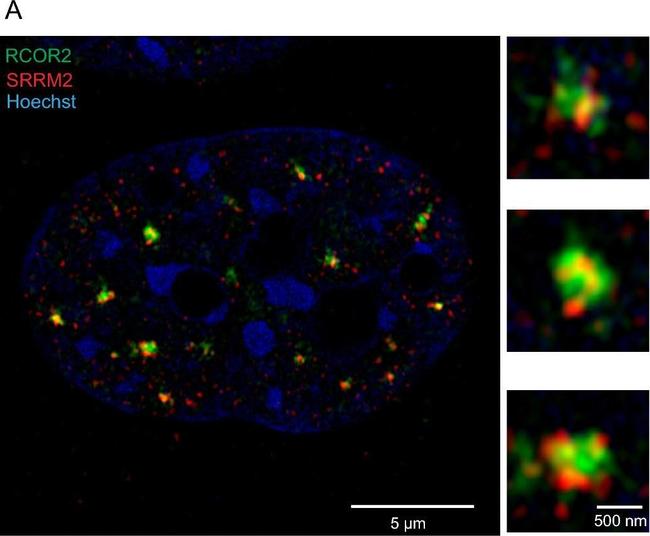 Rabbit IgG (H+L) Secondary Antibody in Immunocytochemistry (ICC/IF)