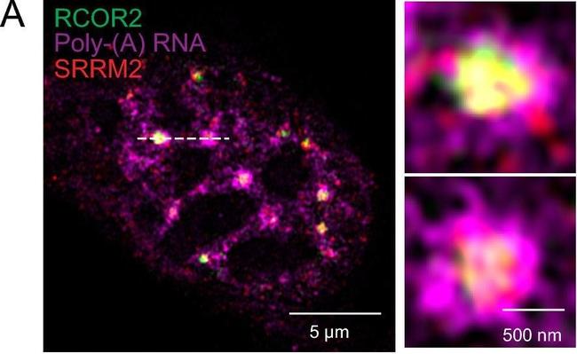 Rabbit IgG (H+L) Secondary Antibody in Immunocytochemistry (ICC/IF)