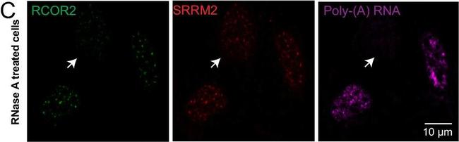 Rabbit IgG (H+L) Secondary Antibody in Immunocytochemistry (ICC/IF)