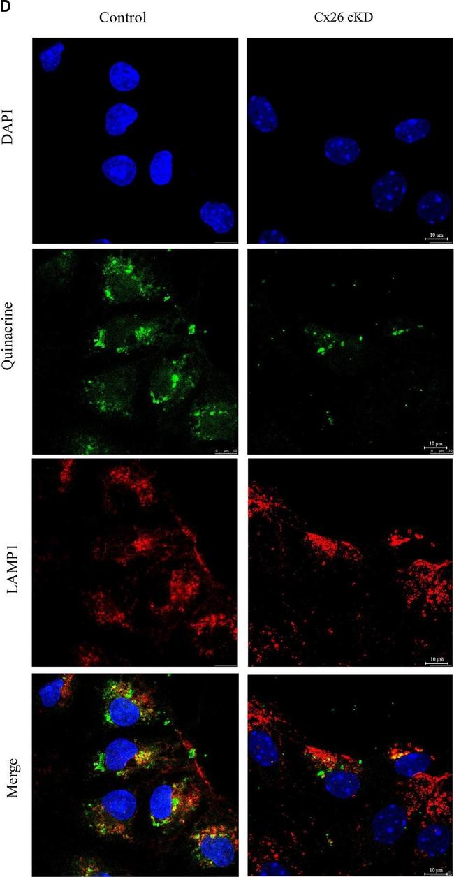 Rabbit IgG (H+L) Secondary Antibody in Immunohistochemistry (Paraffin) (IHC (P))