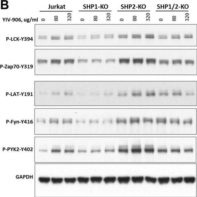 Rabbit IgG (Heavy chain) Secondary Antibody in Western Blot (WB)