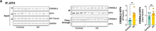 Mouse IgG (H+L) Secondary Antibody in Immunoprecipitation (IP)