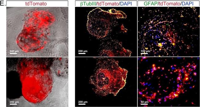 Mouse IgG (H+L) Highly Cross-Adsorbed Secondary Antibody in Immunocytochemistry (ICC/IF)