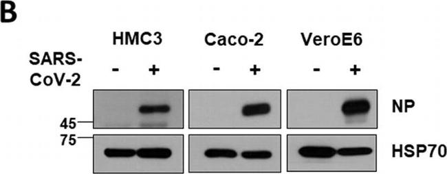 Rabbit IgG (H+L) Highly Cross-Adsorbed Secondary Antibody in Western Blot (WB)